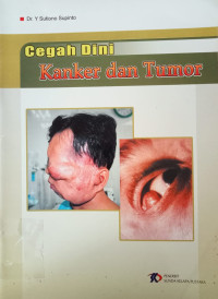 Image of Cegah Dini Tumor dan Kanker